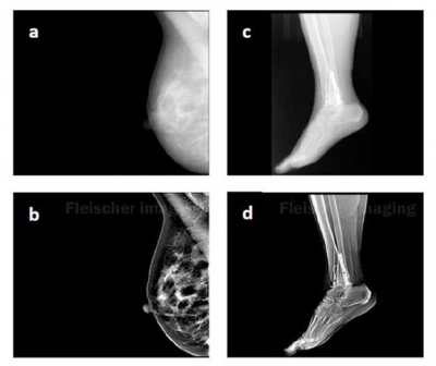 X-ray enhancement brings out details